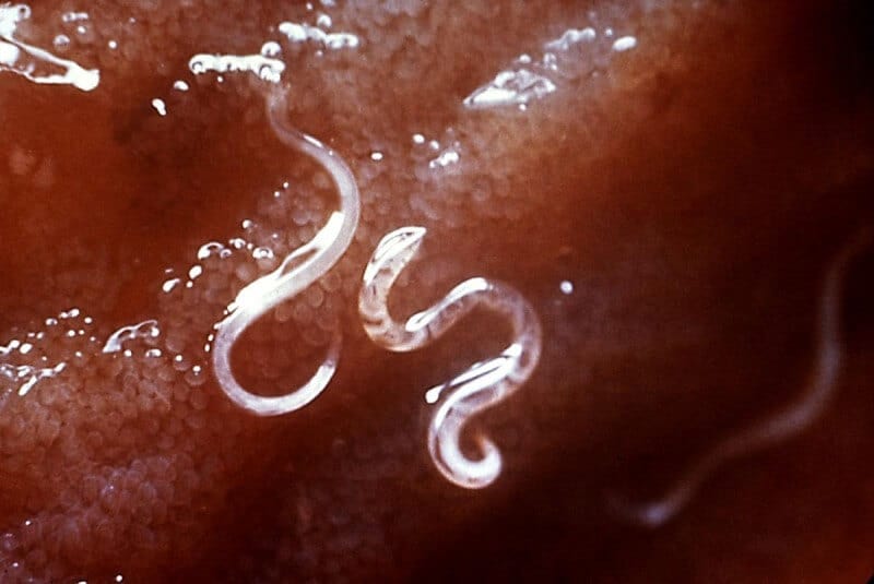nematode hookworms